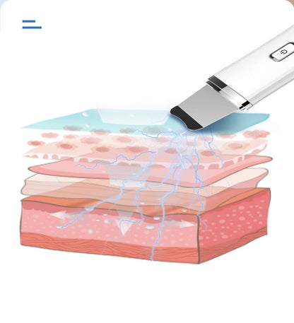 Facial Skin Scrubber , Ultrasonic Skin Scrubber Blackhead Removal Spatula Deep Pore Cleanser Face Skin Spatula Electric EMS Ion Face Lifting Massage